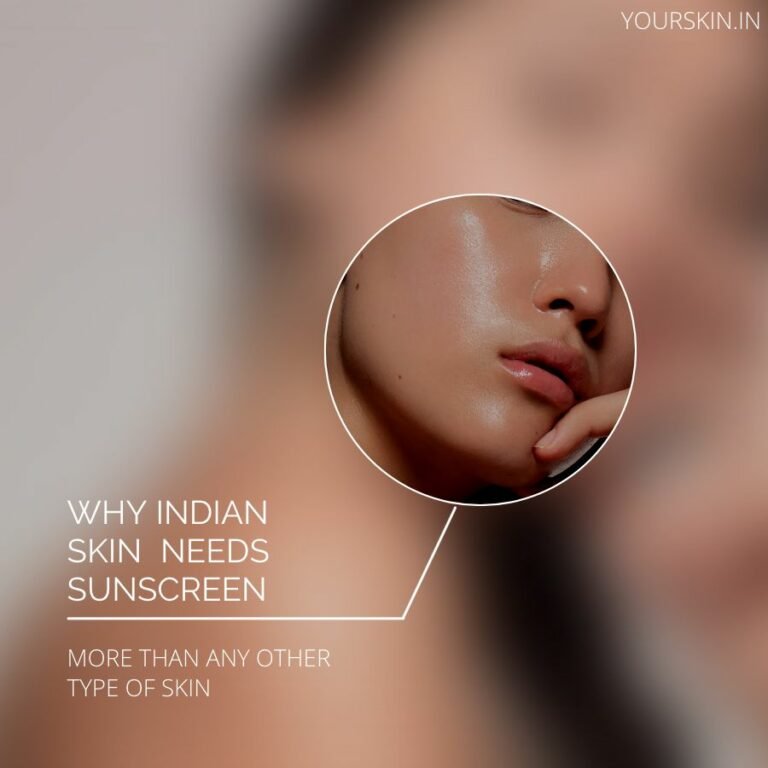 Understanding Hyperpigmentation for Indian Skin in Simple Ways