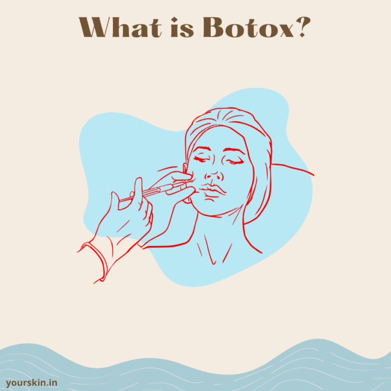 What is Botox – Everything You Need to Know About!