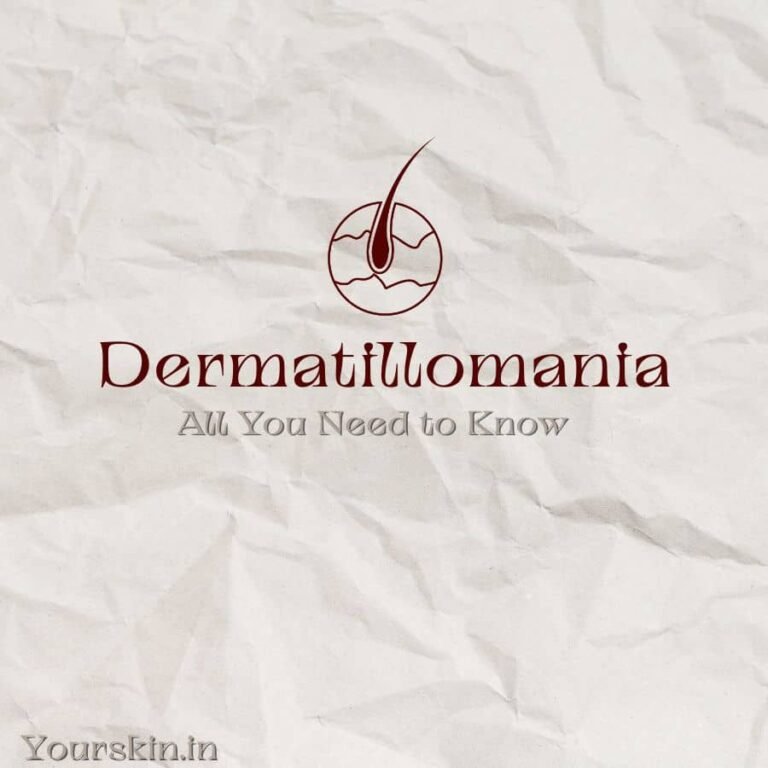 Dermatillomania or Skin Picking Disorder’s Impact on Skin & Scalp